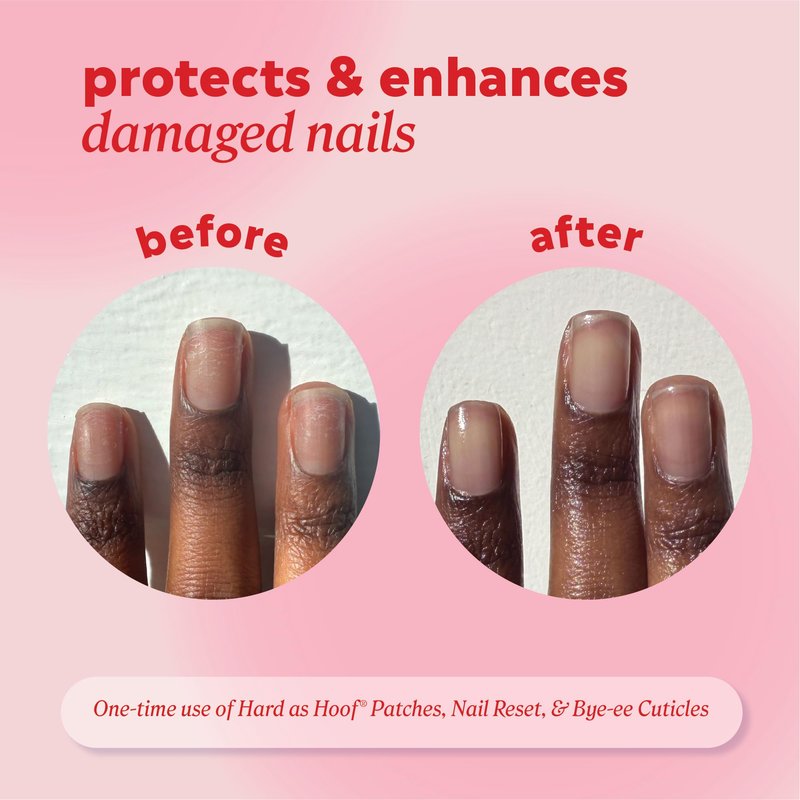 Onyx Professional Hard as Hoof Nail Repair Patches - Nail and Cuticle Strengthening Treatment, Nail Strengthener and Growth, Nail Care, 20 Count