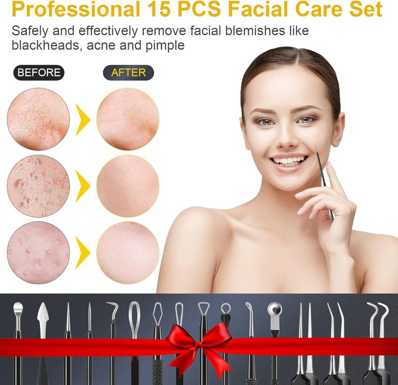 Pimple Popper Tool Kit - 15 PCS Professional Stainless Steel Blackhead Remover Set | Acne Extraction Tools with Metal Case (Black)