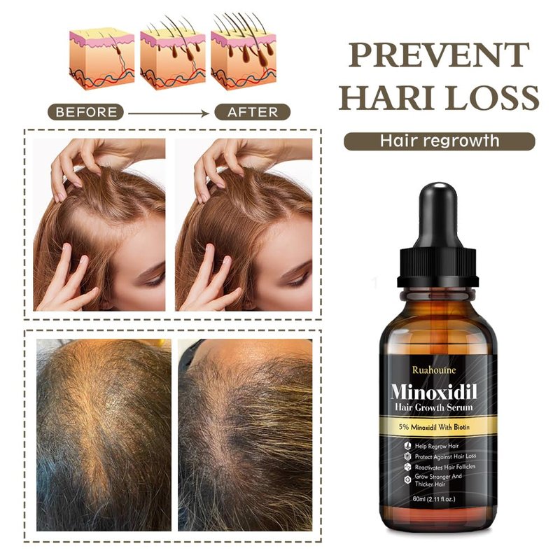Ruahouine Hair Growth Serum - 5% Minoxidil & Biotin for Thicker, Longer Hair | 2.11 fl. oz