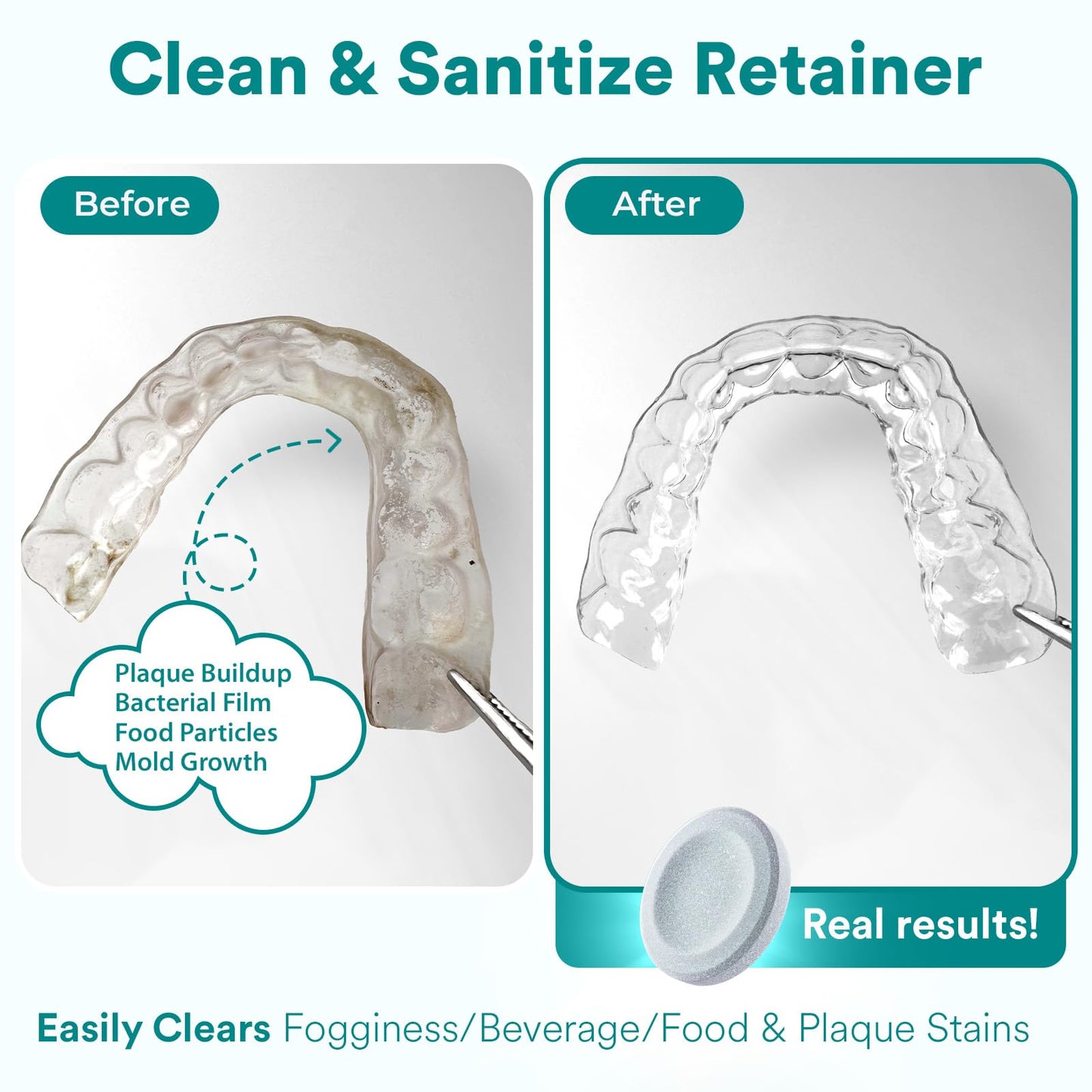 Weiss Naturals Retainer Cleaner Tablets, Invisalign Cleaner, Remove Stains, Odors & Plaque, PERSULFATE FREE Night Guard & Denture Cleaner 4-Month Supply, 120 Mint Scented Tablets