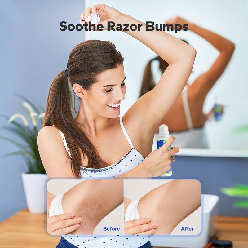 SilkySecret Ingrown Hair Treatment - Razor Burn Relief Lotion for Men & Women | 3.38 Fl Oz