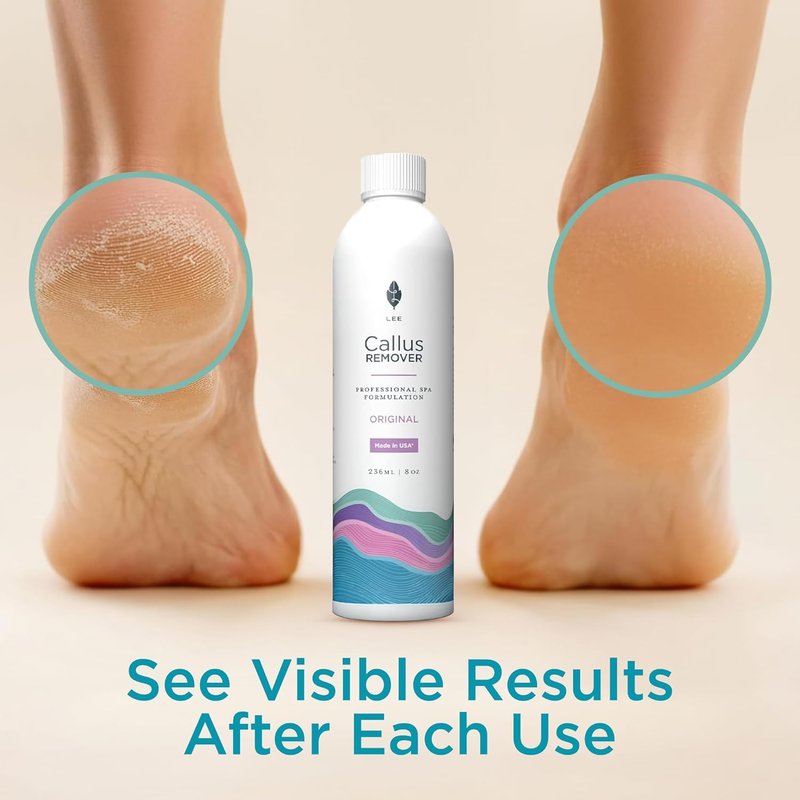 **Lee Beauty 8oz Professional Gel Callus Remover - Fast-Acting Formula for Cracked Heels & Dead Skin**