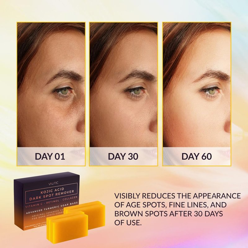 Kojic Acid Dark Spot Remover Soap Bar - Vitamin C, Retinol & Collagen | 4 Pack with Holder