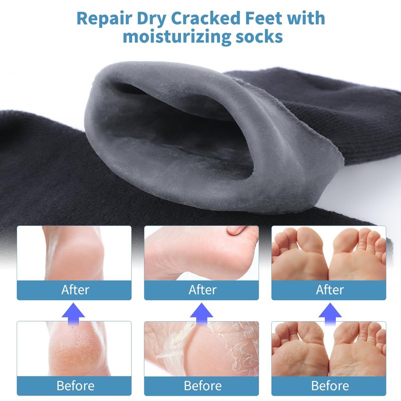 Aluroice 11" Large Silicone Moisturizing Socks for Men - 2 Pairs Soft Foot Care Socks - Feet Moisturizing Socks for Dry Cracked Feet (Size L)