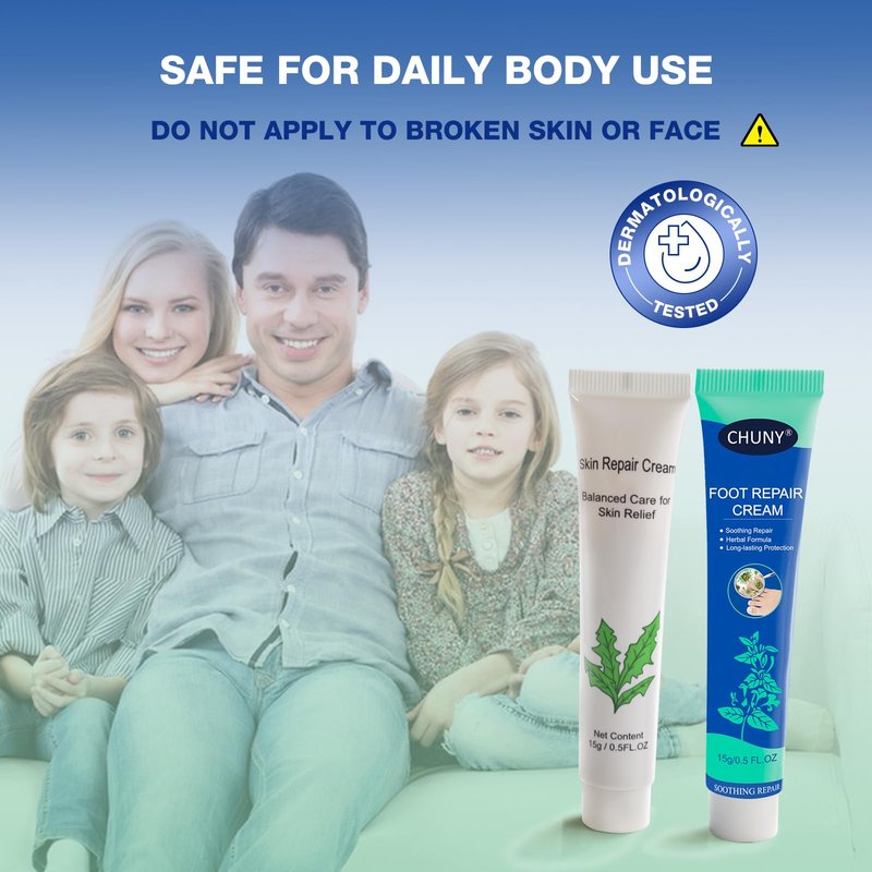 CHUNY Foot Cream for Cracked Heels Cream - Extra Strength for Cracked Heels, Dry Skin & Itchy Feet – Soothes Burning, Scaling & Irritation for Men and Women