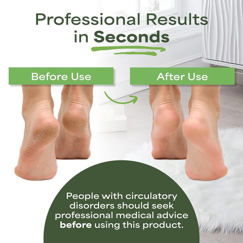 Pedi-wise Pumice Stone for feet Extra Large Foot File & Callus Remover for Cracked Heels Double Sided Pedicure Tool for Dead Skin Podiatrist Recommended