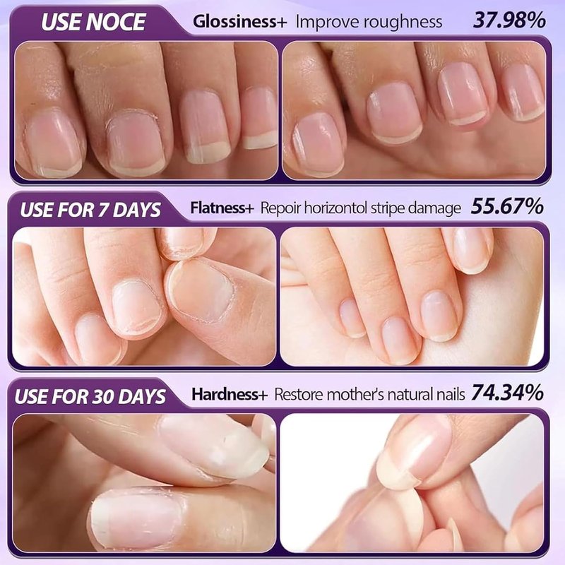 2-in-1 Cuticle Oil Pusher Pen, 2 Pcs Cuticle Oil Pusher Pen for Dry Nails & Cuticles, Nail Cuticle Pen Applicator, Cuticles Remover Pens for Hangnails, Moisturize Strengthen Brighten