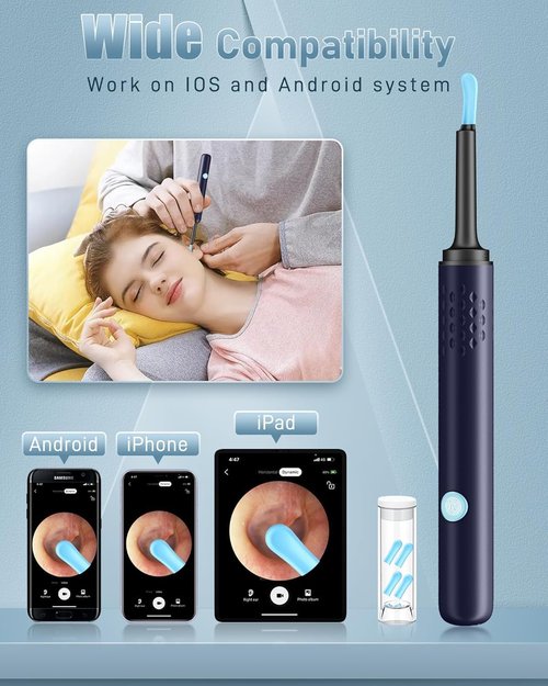 Ear Wax Removal Tool Camera - Ear Cleaner with Camera,1080P Otoscope, Ear Cleaning Tool with 4 Ear Spoon, Ear Camera for iPhone & Android Phones - Blue