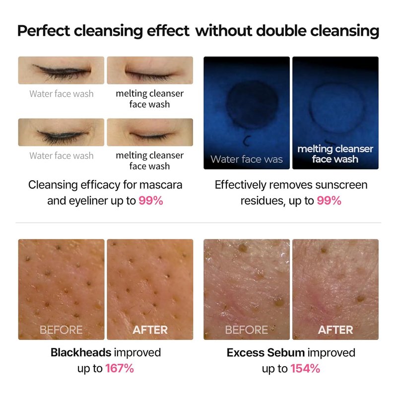 Dr. Melaxin Melting Bubble Foaming Cleanser - Gentle Micellar Makeup Remover with Calamine & Niacinamide for Sensitive Skin