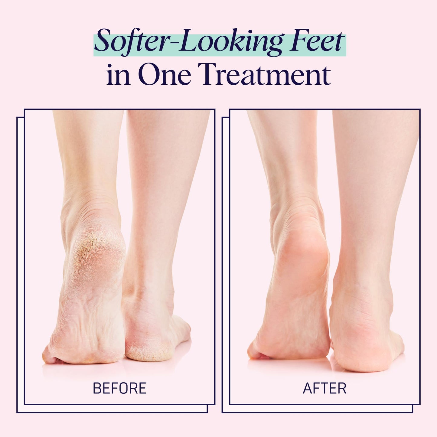 SpaLife Moisturizing Foot Sockies | Foot Mask For Dry Cracked Feet | Tea Tree Oil Softening Booties | Callus Remover Alternative | Self Care Gifts for Women | 8 Pack