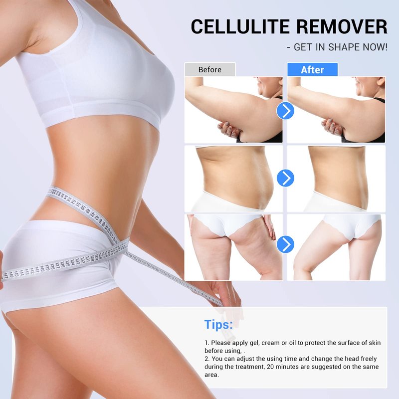 MEIQIER sens for Improvement in The Appearance of Cellulite Device Cellulite Massager Radio Frequency, White