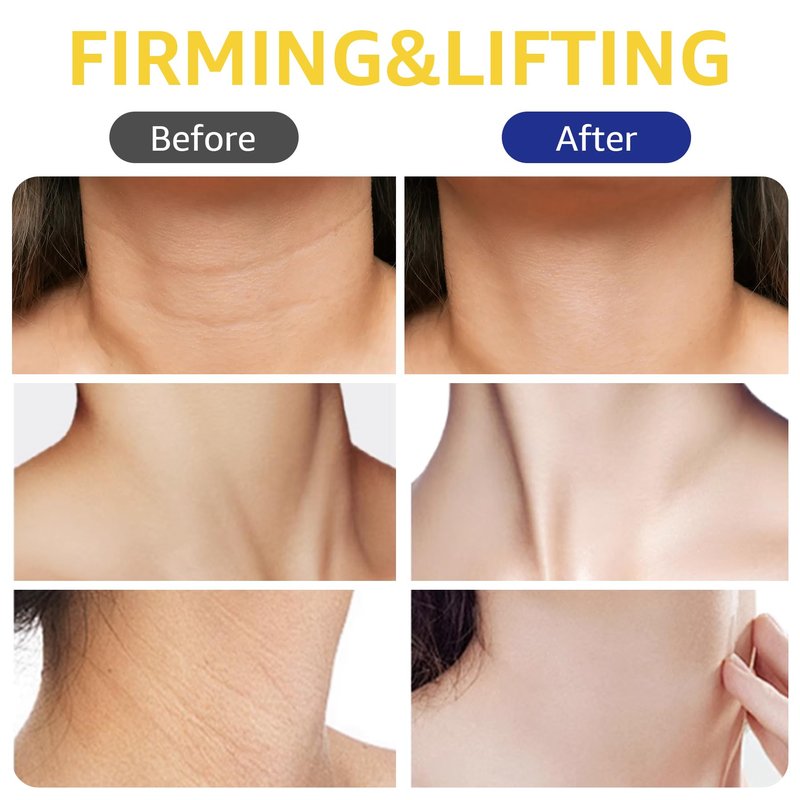 Botanikind Neck Firming Cream with Massage Roller Hydrating & Tightening & Lifting Cream Silky Texture, Wrinkle Neck & Chest Perfecting Cream for Woman (4.23 Fl Oz)