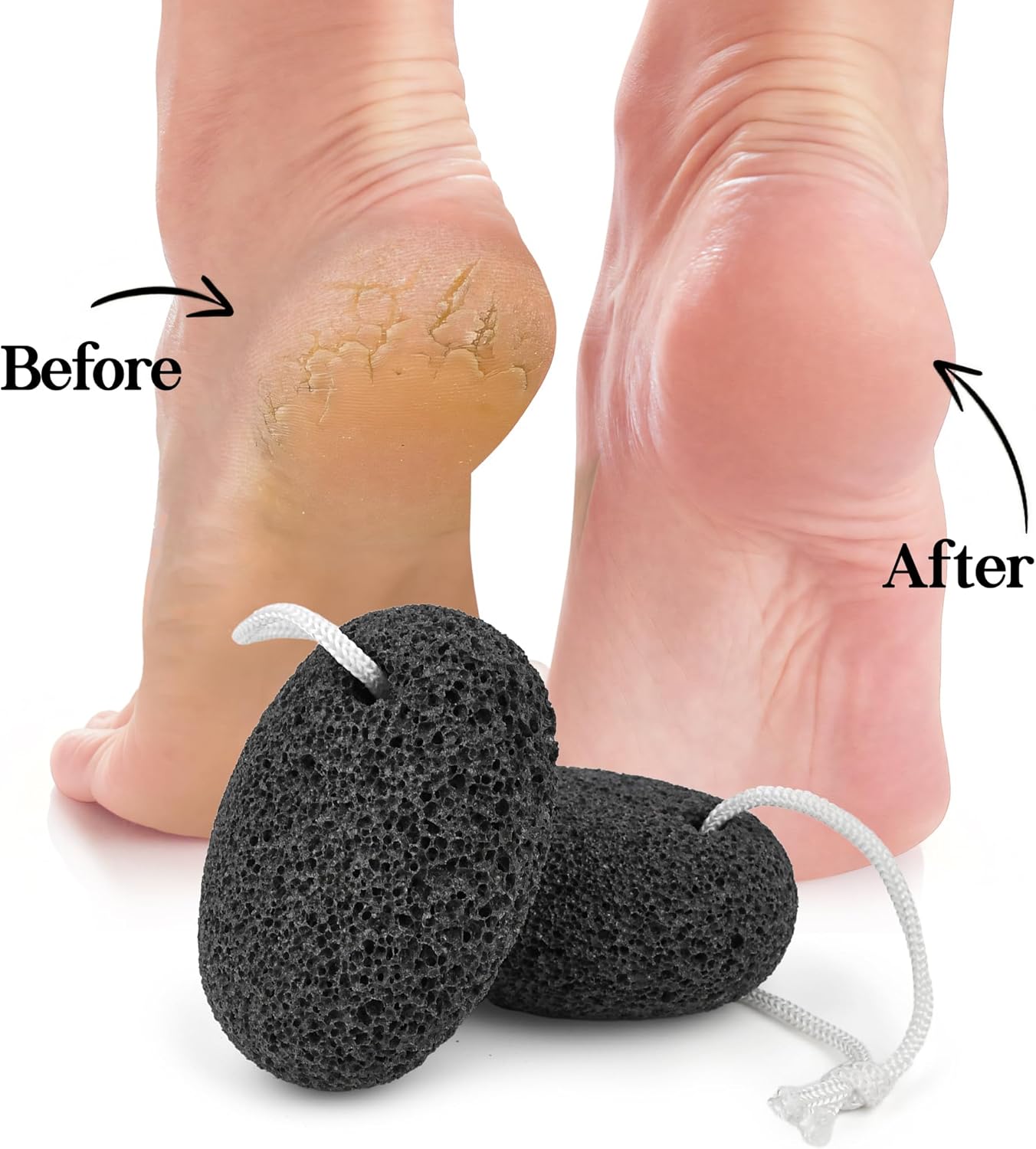 Skiennix Natural Pumice Stone - Effective Dead Skin & Callus Remover | 2-Pack Foot Scrubber