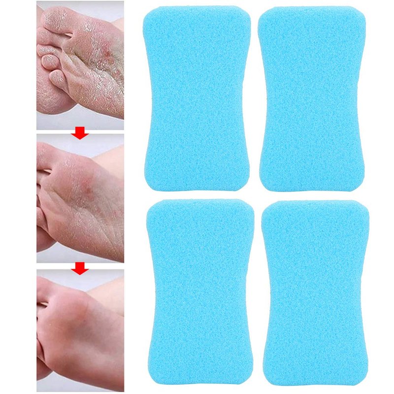 Foot Pumice Stone for Feet Hard Skin Callus Remover and Scrubber, Foot File Exfoliation to Remove Dead Skin (Pack of 4) (Blue)