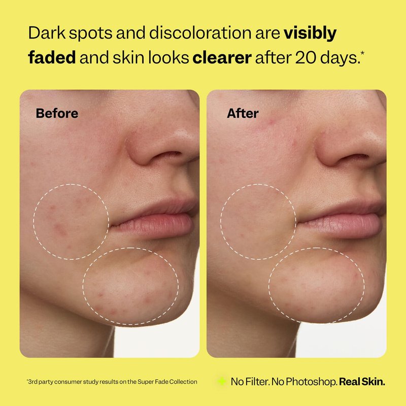 Peach Slices Super Fade Discoloration Serum - Niacinamide & Tranexamic Acid for Dark Spots | 1.01 oz Vegan Korean Skincare