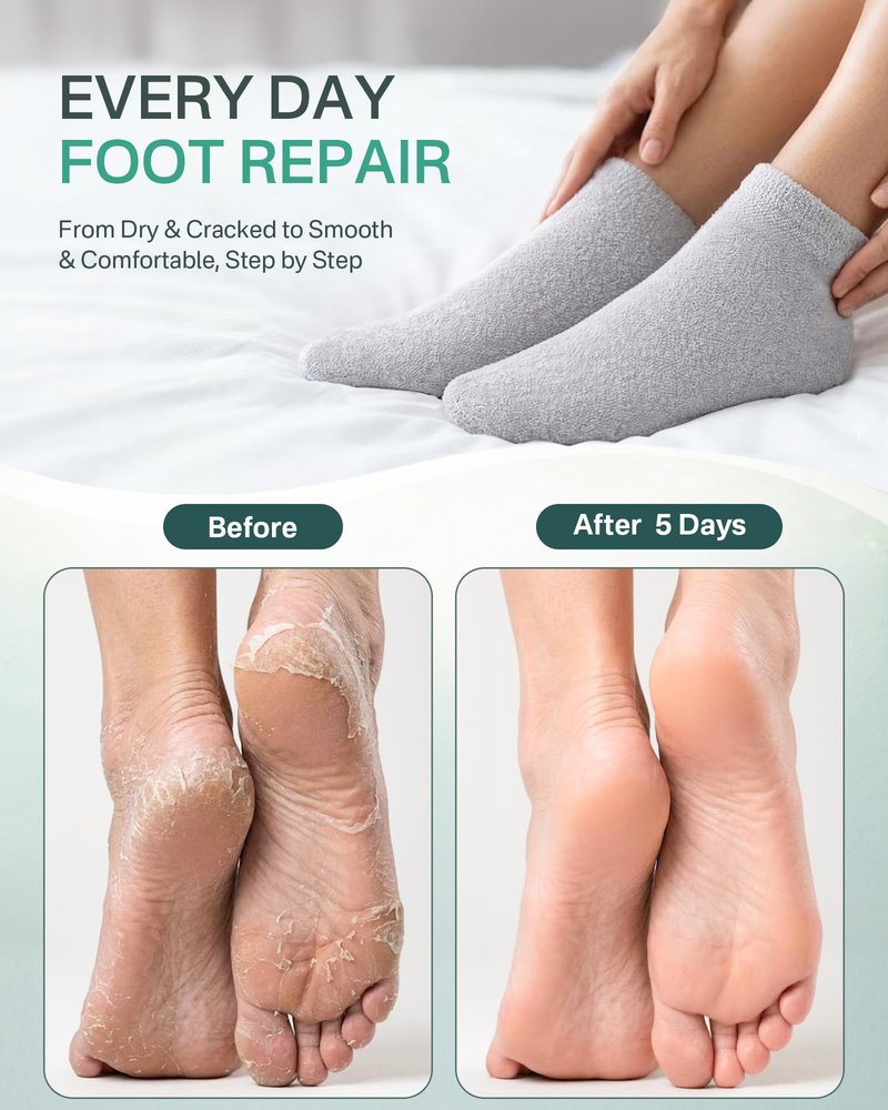 Moisturizing Socks for Dry Cracked Feet, Silicone Socks for Foot Spa(Size 9-11), Gel Socks for Foot Care Overnight, Aloe Socks Heel Protector for Cracked Heel Treatment, Self Care Gifts for Women