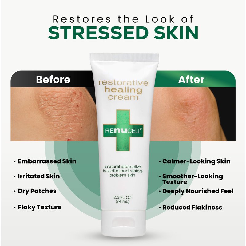 Renucell Restorative Healing Ointment for Itchy and Dry Skin with Natural PHYOXOLIN® – Moisture Barrier Skin Repair Cream to Soothe Cracked, Irritated Skin on Face & Body 2.5 oz