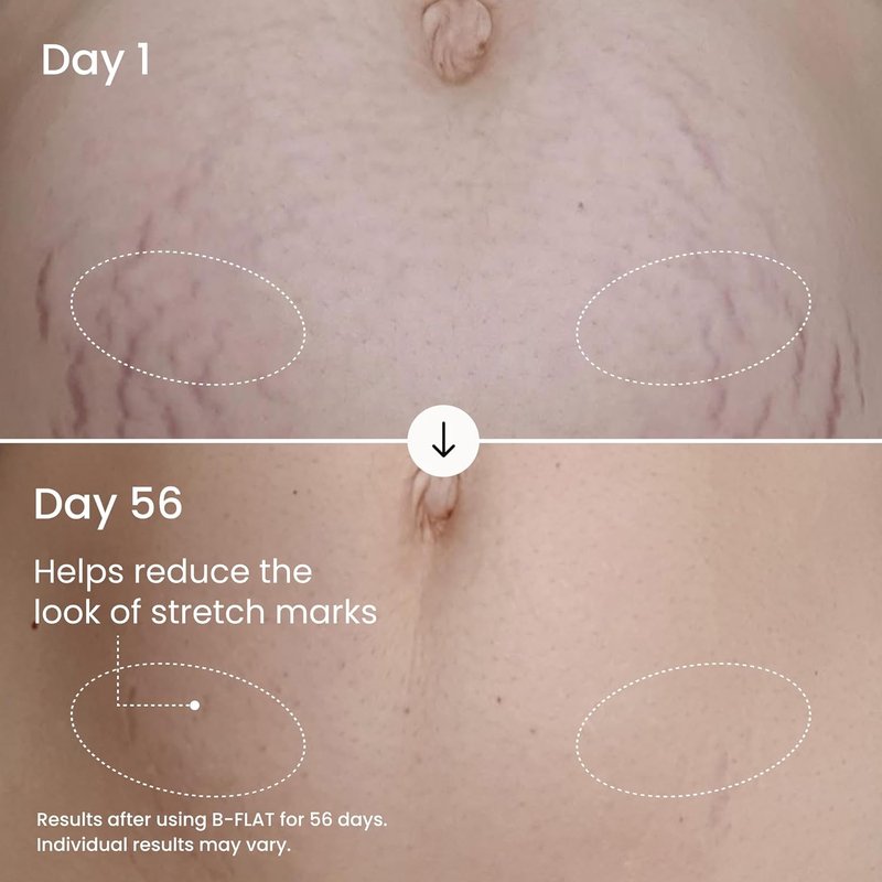 MAËLYS Body Care Set | B-FLAT Belly Firming Cream, B-TIGHT Booty Mask & RE-LURE Serum