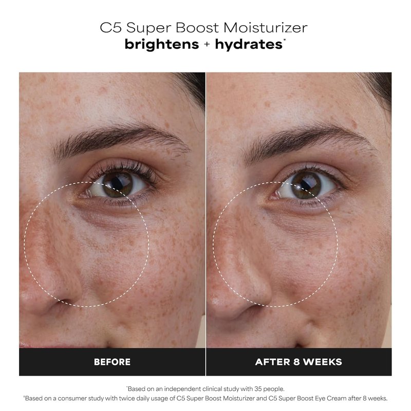 Paula's Choice C5 Super Boost Face Moisturizer - 5% Vitamin C & Squalane for Discoloration & Uneven Tone