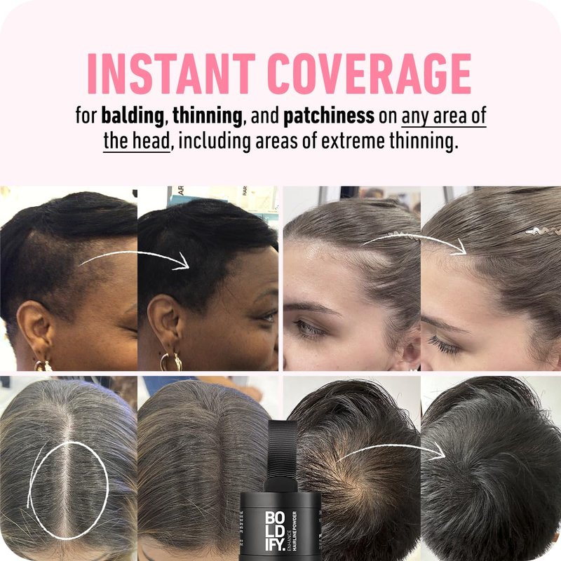 Boldify Hairline Powder & Fiber | Dark Brown Hair Loss Concealer for Thinning Hair