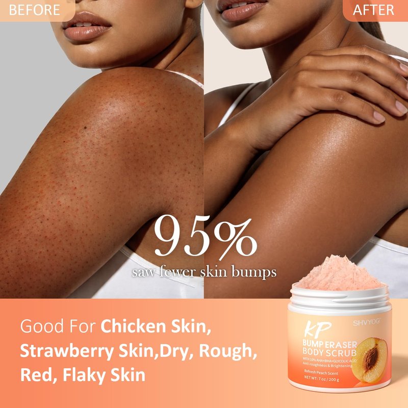 SHVYOG KP Bump Eraser Body Scrub with 10% AHA+BHA & Glycolic Acid, Exfoliating Body Scrub for Chicken & Strawberry Skin, Helps Reduce Skin Bumps, Soothe Rough Redness, Ingrown Hair, Peach Scent 7 Oz