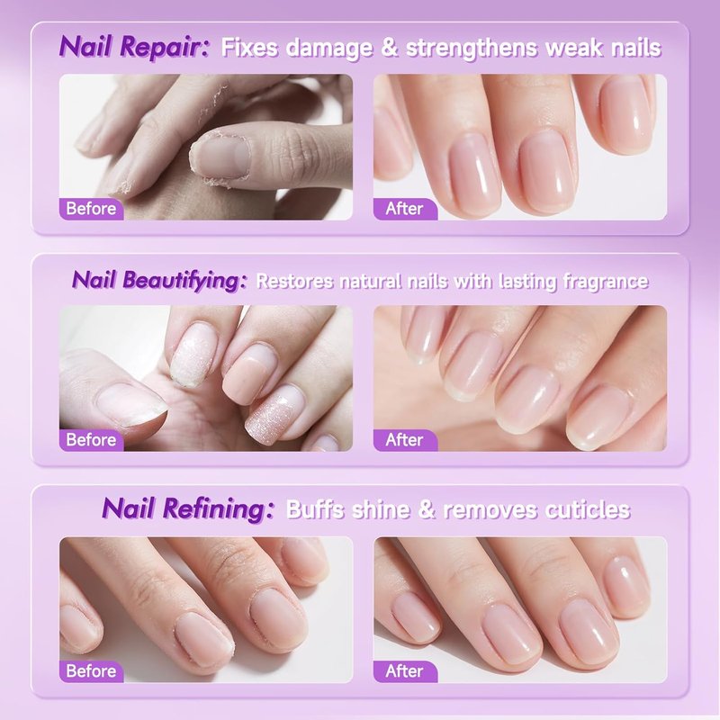 Cuticle Oil Pen - 4-in-1 Nail Treatment with Ceramic Tip | Cuticle Remover for Hangnails & Damaged Nails
