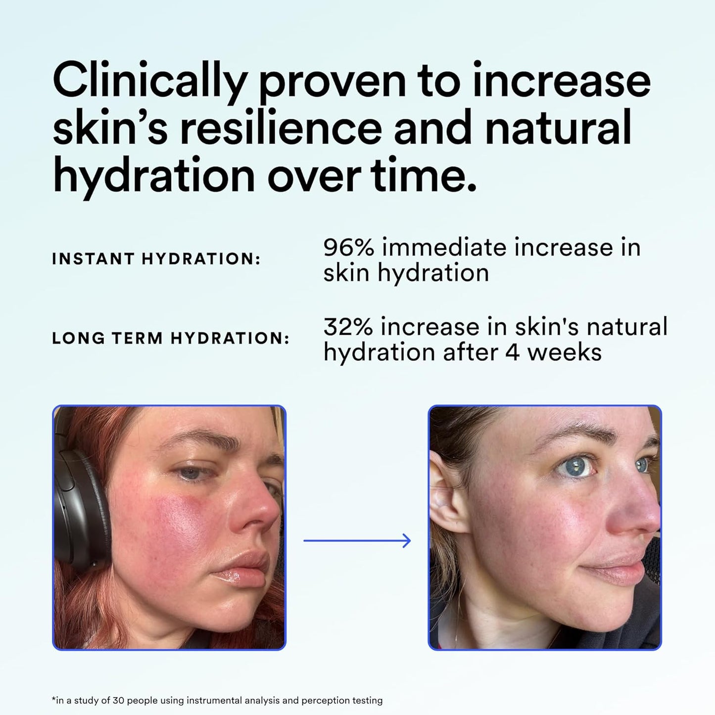Ultra Hydrating Barrier Serum - 30% Glycerin & Polyglutamic Acid for Plump, Dewy Skin | 1.35 FL OZ