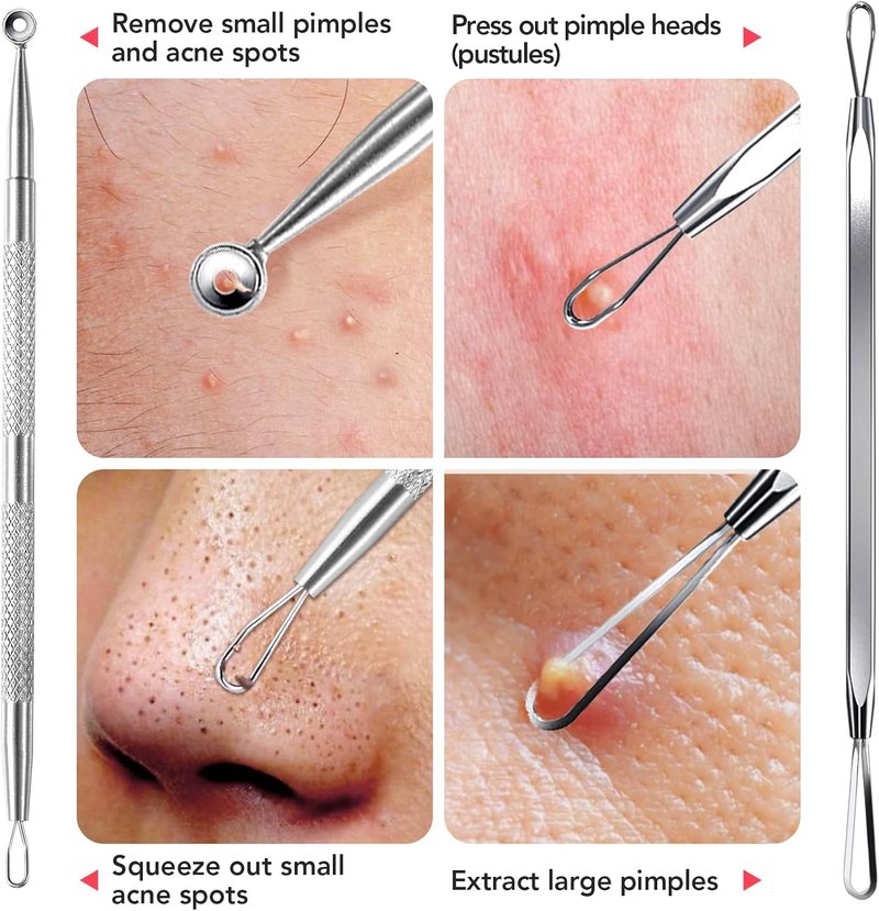 Litbear Blackhead Remover Tool Kit - 6 Pcs Acne Extractor Set with Leather Case for Deep Cleansing