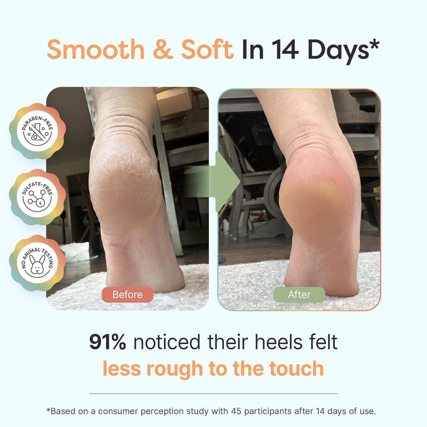 ZenToes Urea Cream 40 Percent for Feet | Foot Lotion for Dry Cracked Heels and Feet | Intense Dry Feet Softening and Hydration for Skin | Heel Balm and Moisturizing Care | 5oz