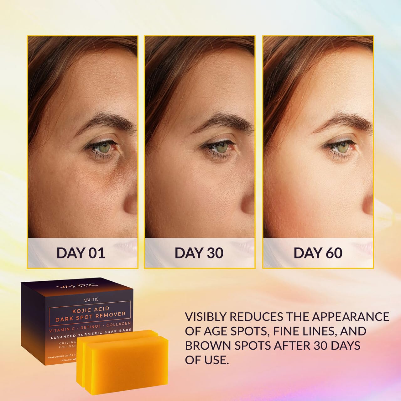 VALITIC Kojic Acid Dark Spot Remover Soap Bars with Vitamin C, Retinol, Collagen, Turmeric - Original Japanese Complex - Hyaluronic Acid, Vitamin E, Shea Butter, Olive Oil (2 Pack) - With Soap Holder