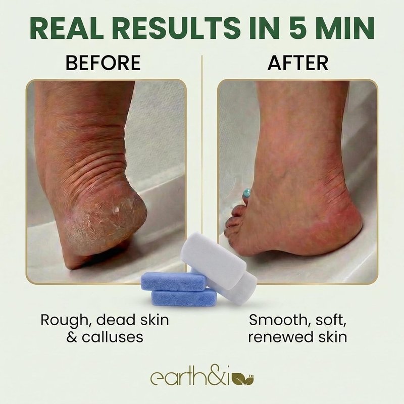 Pumice Stone for Feet - 2-Pack Coarse & Fine Dual-Grit Callus Remover | Heel Exfoliator for Baby-Soft Skin