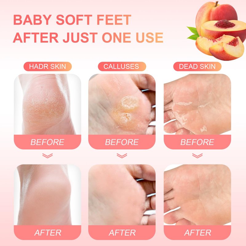 FUNNIR Foot Peeling Mask Exfoliant for Peeling Off Calluses, Natural Exfoliator for Dry Dead Skin, Callus, Repair Rough Heels Soft Smooth Touch