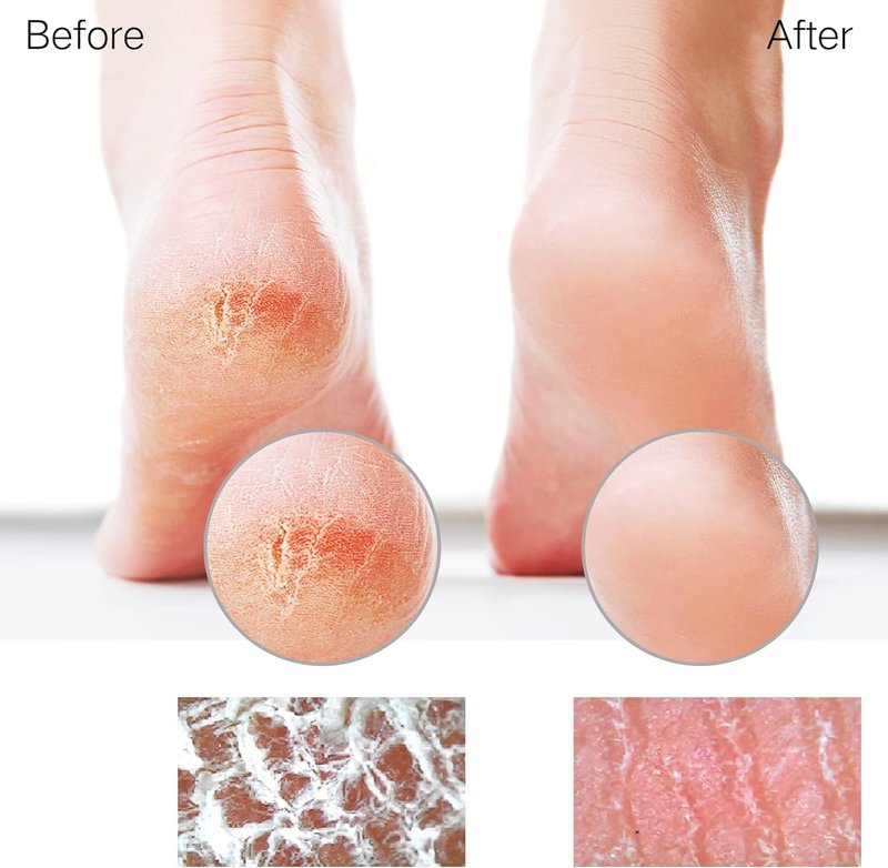 Glass Foot File Callus Remover - Professional Pedicure Tool for Dead Skin & Diabetic Feet | Heel Scraper & Pumice Stone