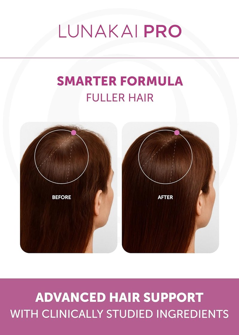 Hair Growth Supplement for Women - Advanced 20 Nutrient Formula with Marine Collagen, Biotin & Keratin - 90 Capsules for Thicker Strands