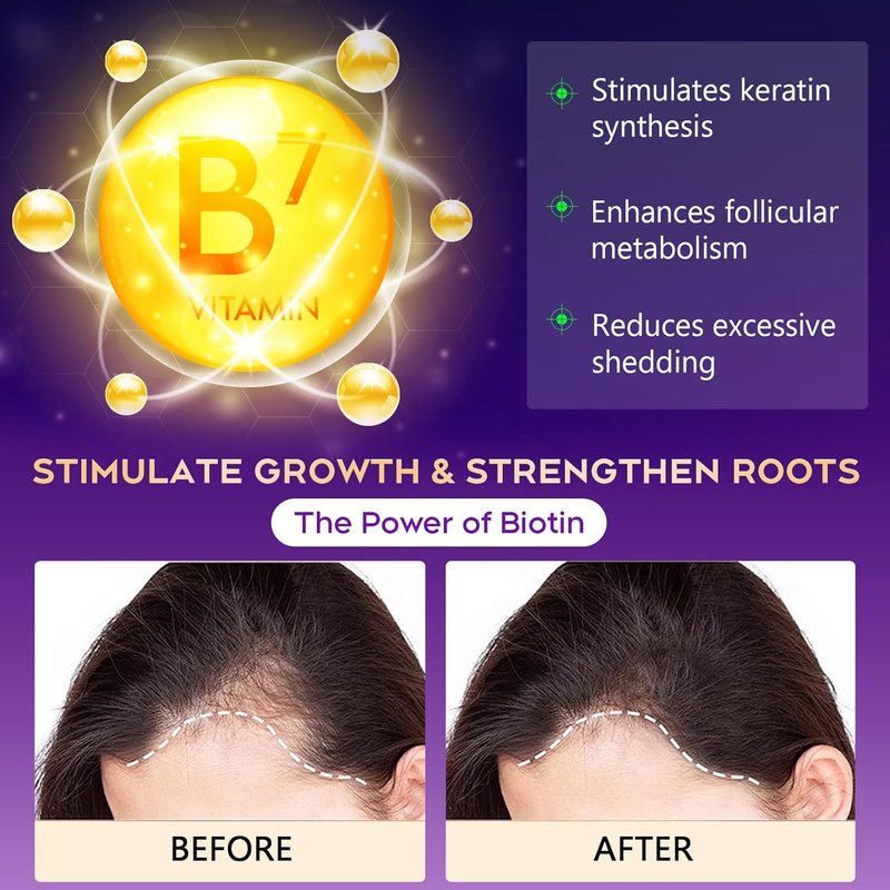 Biotin Hair Growth Shampoo - Sulfate-Free Thickening Formula for All Hair Types | 10.1 Fl Oz