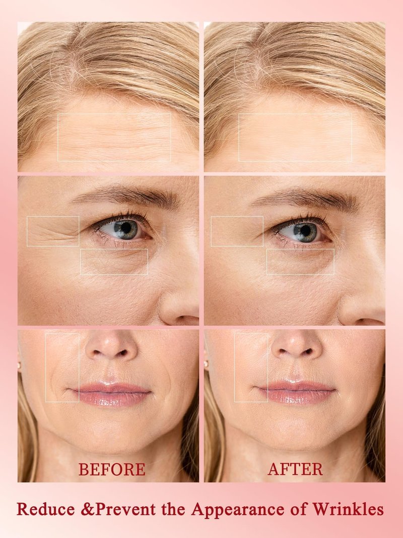 Radio Frequency Skin Tightening Device - Anti-Aging Face Machine for Wrinkle Removal & Firming | Wireless Home Beauty Tool with 3 Levels