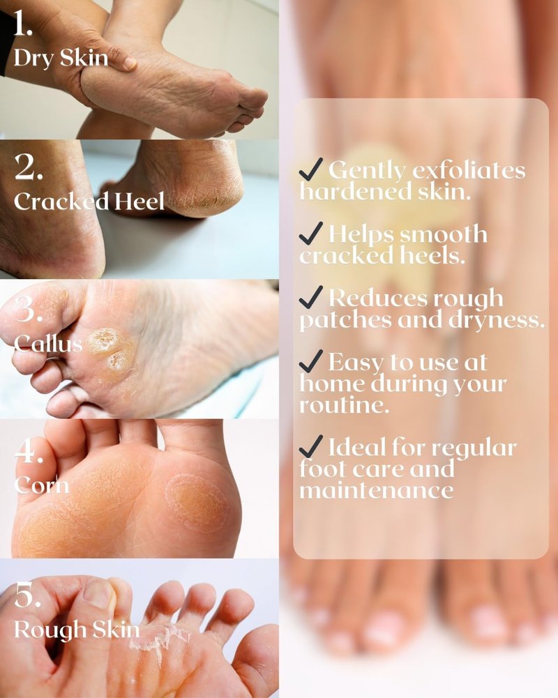 PrimeVarieties Pumice Stone for Feet, 2 Pack Natural Volcanic Foot Pumice Stone for Callus & Dead Skin Removal, Pedicure Foot Scrubber, Hard Skin Remover for Smooth Heels