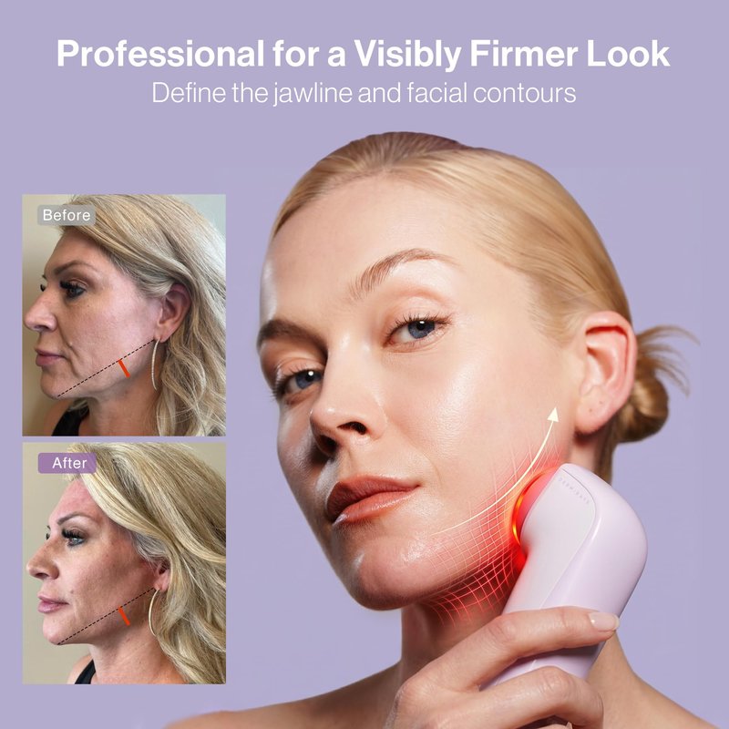 DermRays Multi-RF Microcurrent Device with 650nm Red Light, 4-in-1 Facial Toning Tool with Multi-Leading Tech for a Visibly Radiant & Youthful Appearance