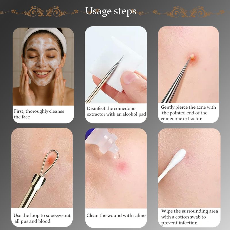 10PCS Blackhead Remover Pimple Popper Tool Kit, Professional Stainless Steel Extractor Removal Tools for Comedone, Acne, and Pimple