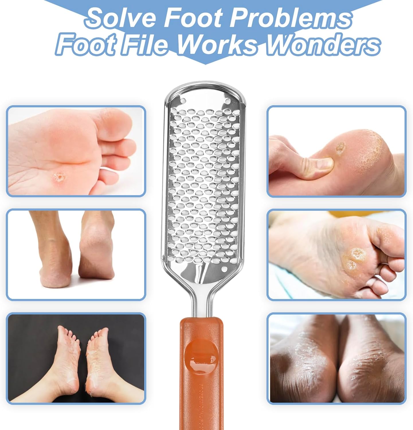 Skiennix Professional Foot Scrubber - Dead Skin Remover & Callus File for Cracked Heels | Pedicure Tool