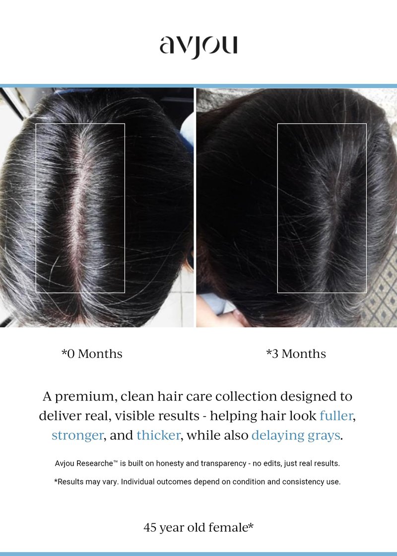 Avjou Researche™ Scalp Serum – Thicker, Fuller-Looking Hair + Targets Visible Signs of Premature Greying – 3 Patented Ingredients – Backed by Cosmetic Science – Oil-Free, All Hair Types, 1.7 oz