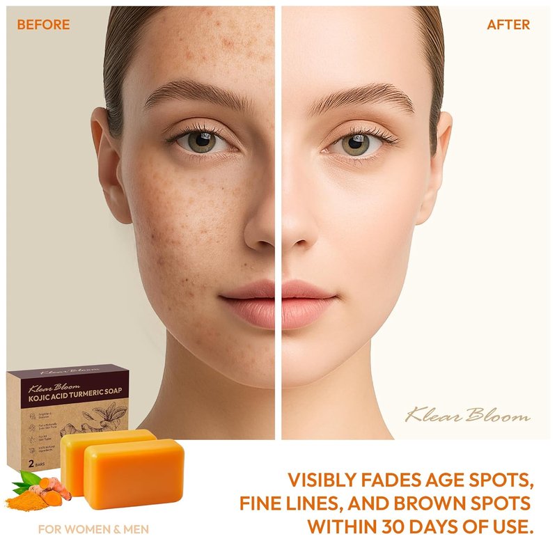 Kojic Acid Soap, Turmeric Soap Bar for Dark Spots Brightening & Moisturizing with Collagen, Vitamin E, Retinol, Hyaluronic Acid, Shea Butter, Paraben & Sulfate-Free 105g x 2 Bars