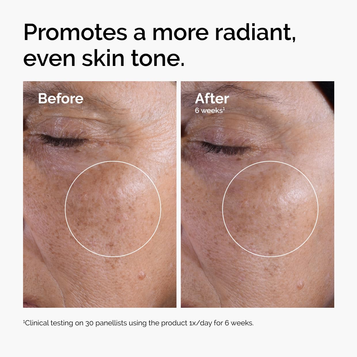 The Ordinary Glycolic Acid 7% Exfoliating Toner - Brightening Daily Solution for Even Skin Tone