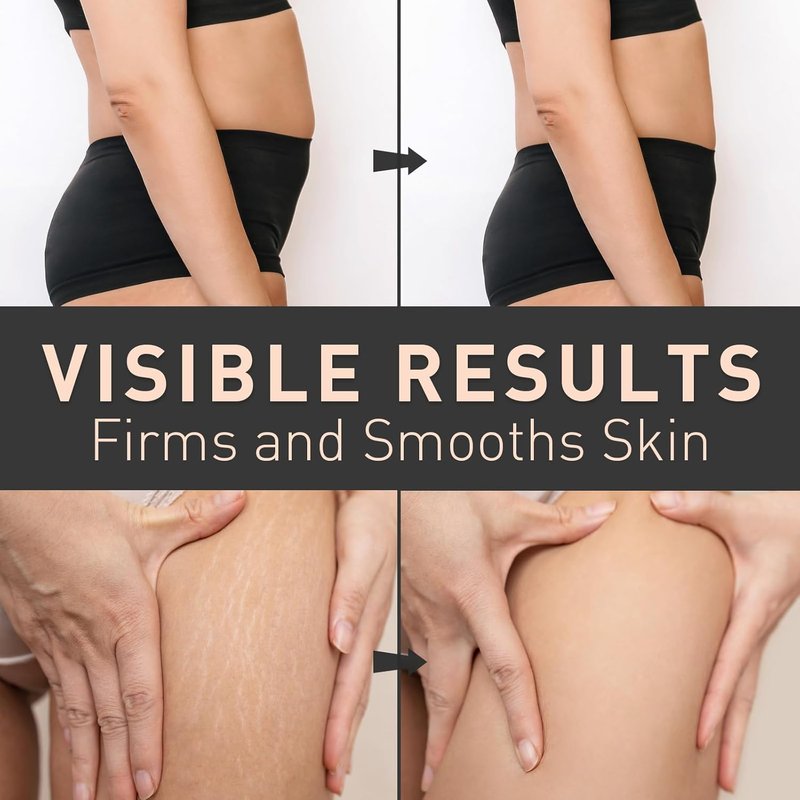 Belly Firming Cream - Skin Tightening & Cellulite Reduction | Hydrating Lotion for Stomach, Thighs & Booty - 100 mL Orange