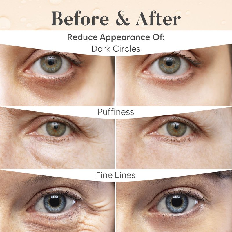 AURAE Variety Under Eye Patches (30 Pairs) - Eye Mask for Dark Circles, Puffiness & Care - Hyaluronic Acid, Green Tea, Rose, 24K Gold, Retinol & Collagen