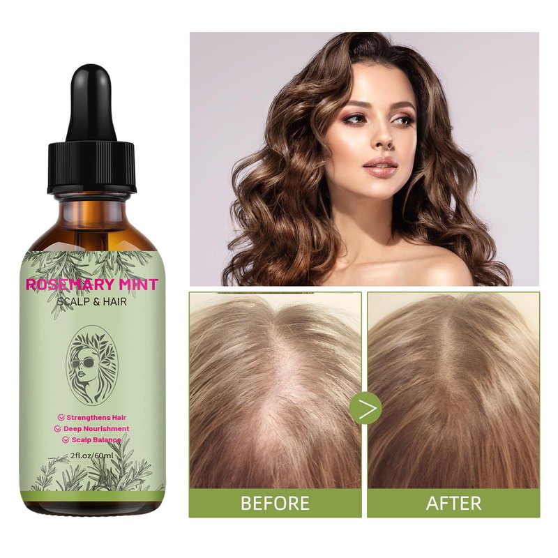 Rosemary Mint Scalp & Hair Oil – Strengthening & Nourishing Treatment for Hair Growth, Dry Scalp & Breakage – Natural Botanical Blend – 2 fl oz