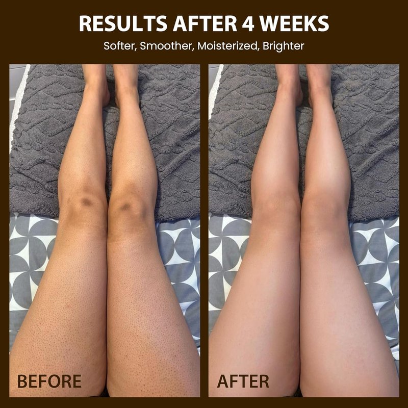 Organic Robusta Coffee Body Scrub - Moisturizing Exfoliant with Coconut Oil & Shea Butter | 8 oz for Cellulite & Fine Lines