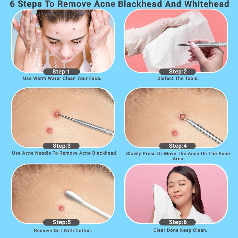 EFAH Care 2Pcs Stainless Steel Pimple Extractor Acne Treatment Tool Surgical Blemish Grade Blackhead Remover Perfect for face and Nose Easy to Clean (Silver)