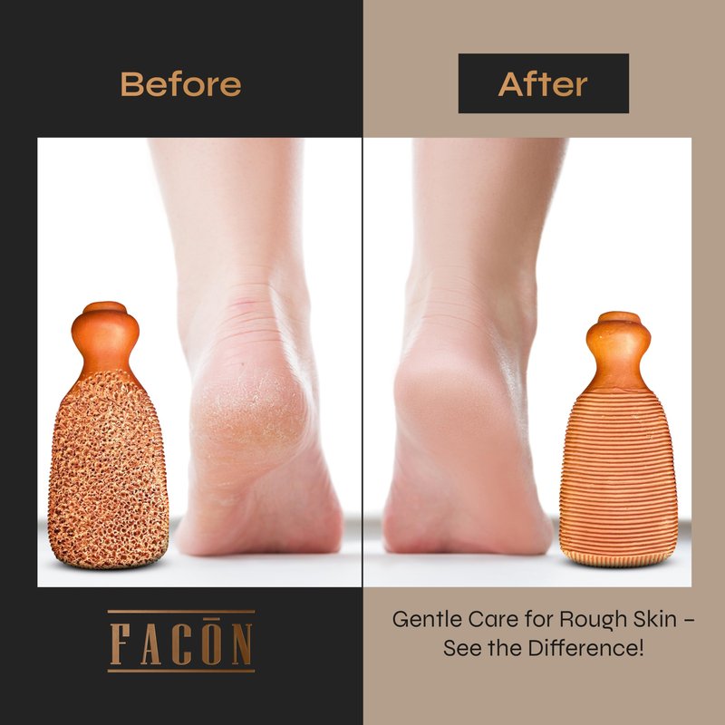 Facón Pumice Stone for Feet Callus Remover - Terra-Cotta Foot Scrubber with 2 Sides, 100% Pure Natural Foot Pumice Stone, Pedicure Pumice Stone Scrubber, Foot Exfoliator, Removes Calluses & Dead Skin