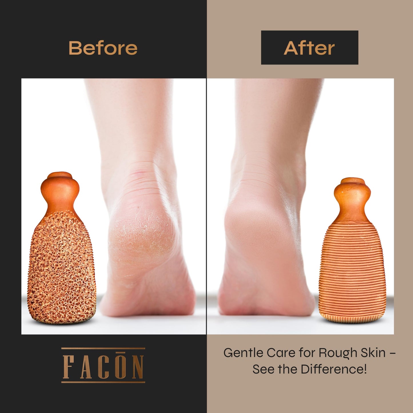 Facón Pumice Stone for Feet Callus Remover - Terra-Cotta Foot Scrubber with 2 Sides, 100% Pure Natural Foot Pumice Stone, Pedicure Pumice Stone Scrubber, Foot Exfoliator, Removes Calluses & Dead Skin